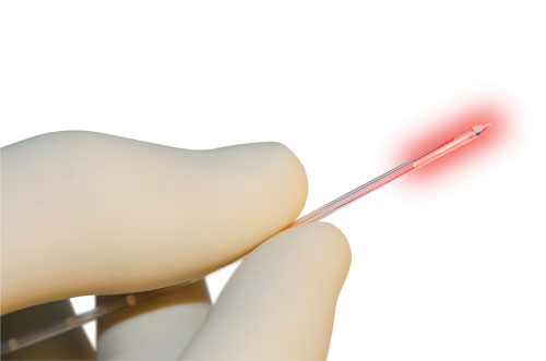 Dr. Merkow brings laser treatment for brain tumors to the East Bay